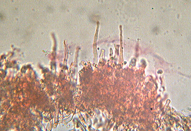 Hyphoderma sambuci